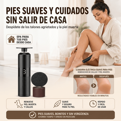 Lijadora Eléctrica Suave para Pies – Removedor de Callos y Piel Muerta